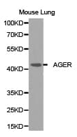 Polyclonal Rabbit anti-Human AGER / RAGE Antibody (IHC, WB)
