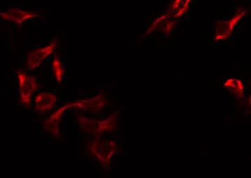 MRPS12 / RPSM12 Antibody
