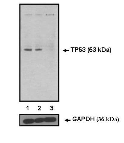 Tumor suppressor p53 Antibody (Amino Acid: 16-25, clone BP53-12)