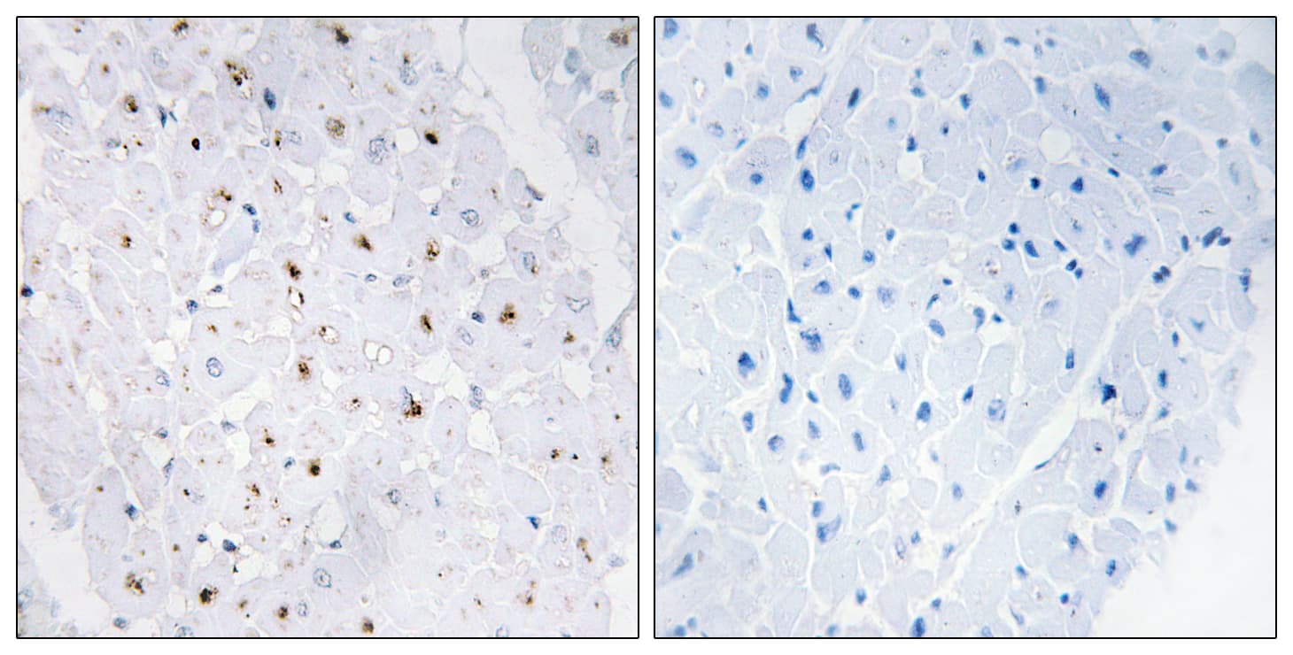 BLM Antibody (phospho-Thr99)