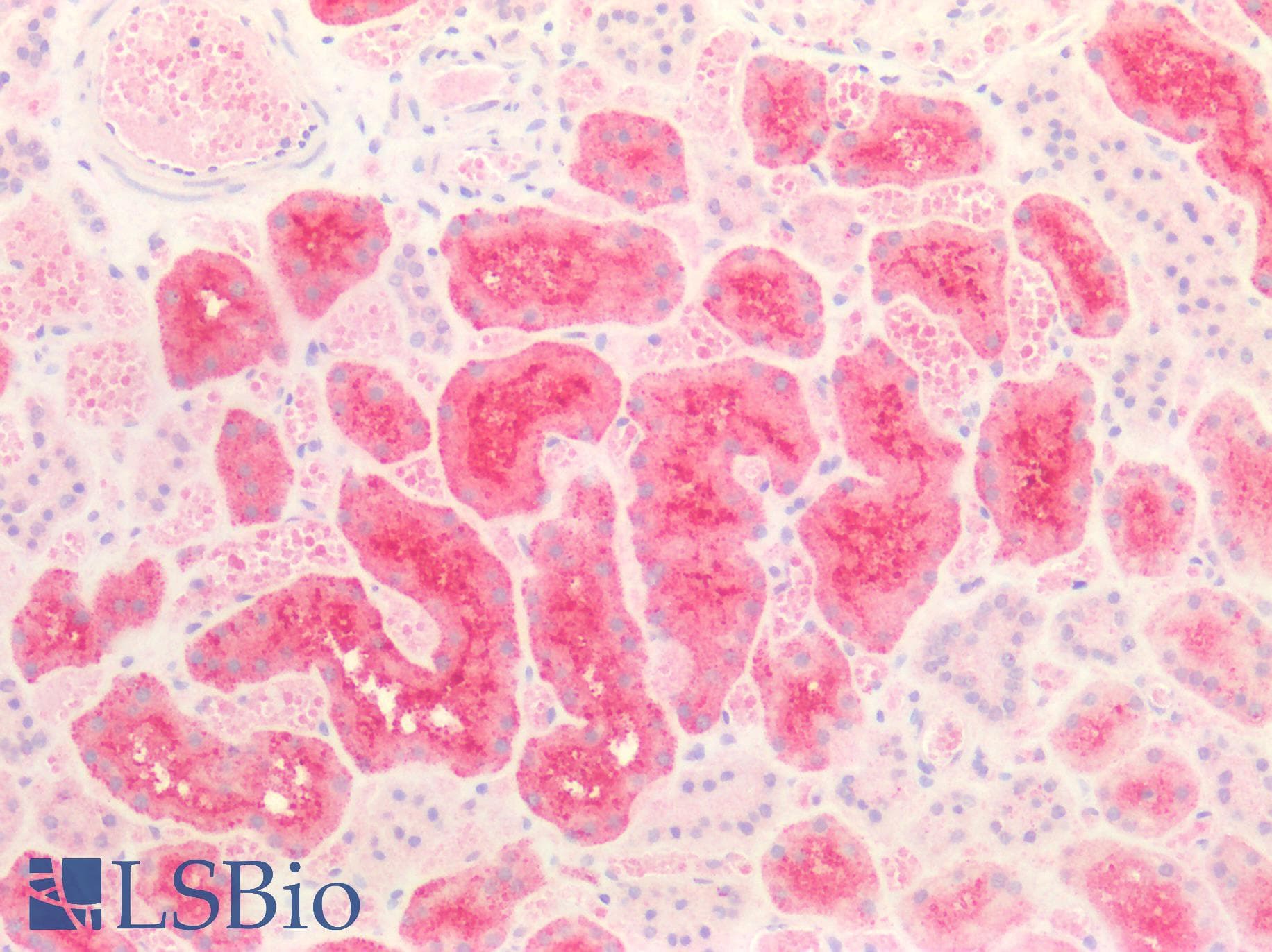 PathPlus™ Polyclonal Rabbit anti-Human FOLR1 / Folate Receptor Alpha Antibody (IHC)