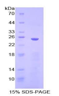 Human IKBIP Protein (Recombinant His-T7)
