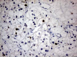 Monoclonal Mouse anti-Human MKI67 / Ki67 Antibody (clone OTI1F11, Carrier-free, aa1160-1493, IHC, WB)