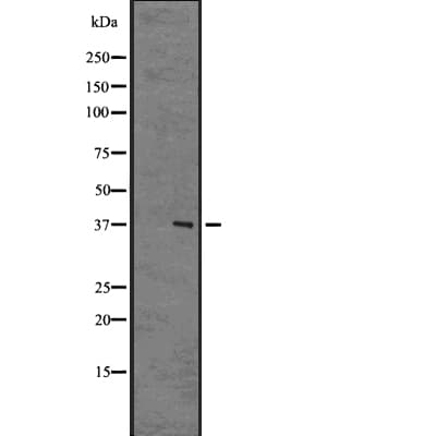NPBWR2 / GPR8 Antibody
