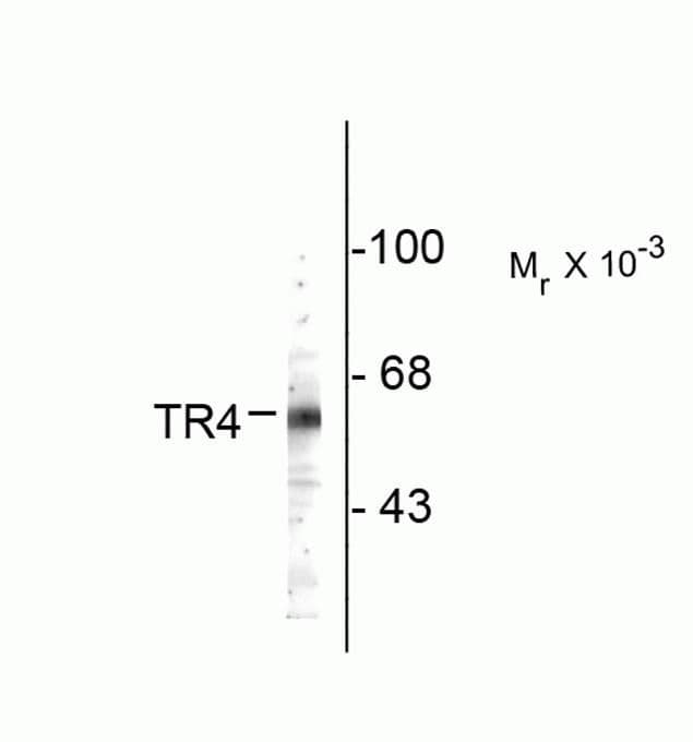 NR2C2 / TAK1 Antibody