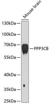 Polyclonal Rabbit anti-Human PPP3CB Antibody (WB)