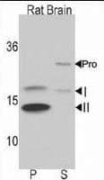 Polyclonal Rabbit anti-Human MAP1LC3B / LC3B Antibody (aa1-30, IHC, IF, WB)