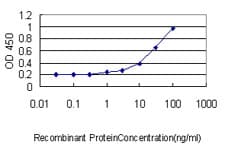 Monoclonal Mouse anti-Human ACTR2 / ARP2 Antibody (clone 1B10-C4, IHC, WB)