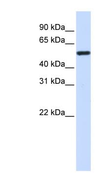 Polyclonal Rabbit anti-Human TUBA4A / TUBA1 Antibody (C-Terminus, WB)