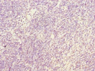 Polyclonal Rabbit anti-Human NFYB Antibody (IHC)