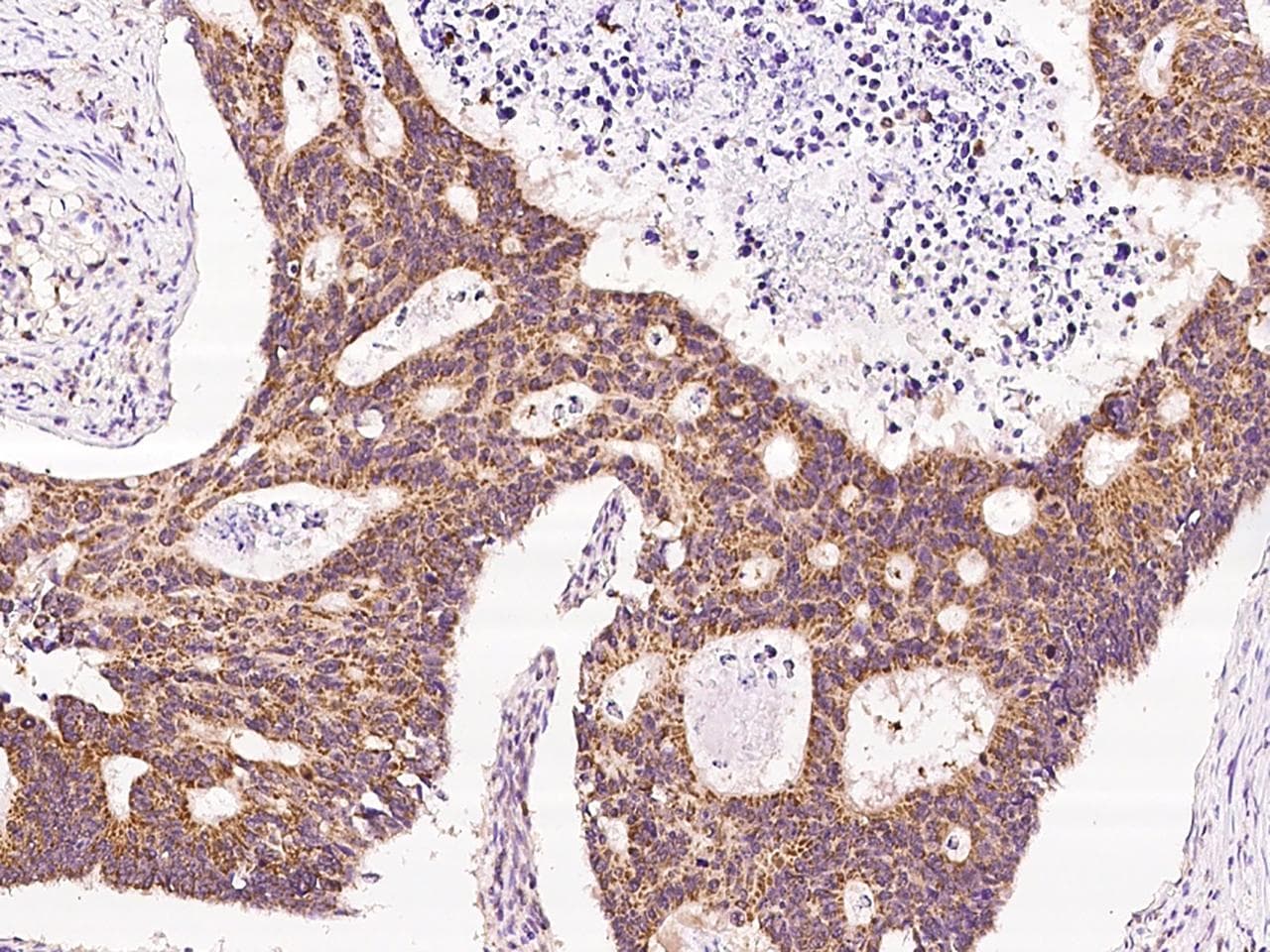 BCKDHA / BCKDE1A Antibody