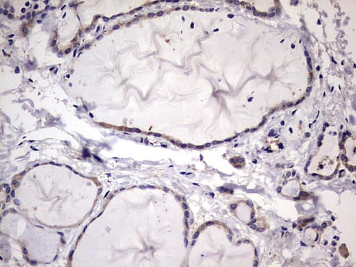 KYNU Antibody (aa1-216, clone OTI1H1)