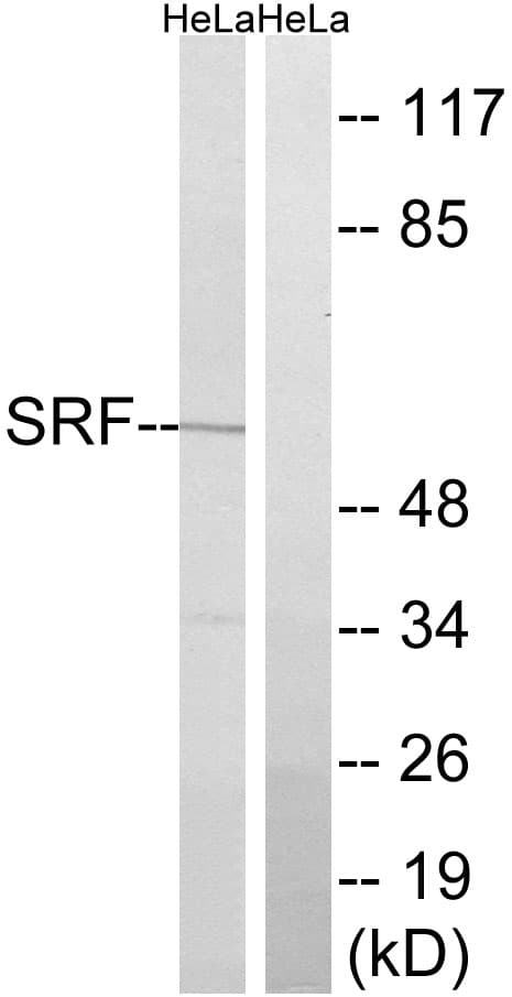 SRF / Serum Response Factor Antibody (aa126-175)