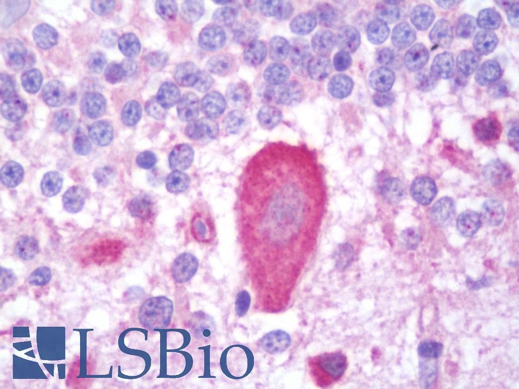 IHC-plus™ Polyclonal Rabbit anti-Human ITPR3 Antibody (aa625-675, IHC, IF)