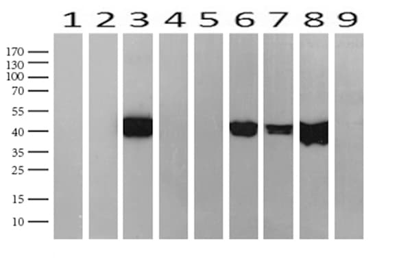 KRT19 / CK19 / Cytokeratin 19 Antibody (aa240-390, clone UMAB186)