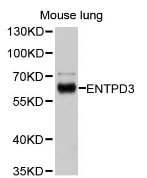 ENTPD3 Antibody