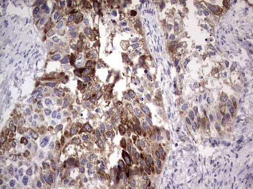 LAMB3 / Laminin Beta 3 Antibody (aa424-773, clone OTI3A2)