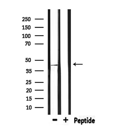 ARRB2 / Beta Arrestin 2 Antibody
