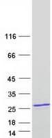 Human TNNI2 Protein (Recombinant Myc-DDK (Flag))