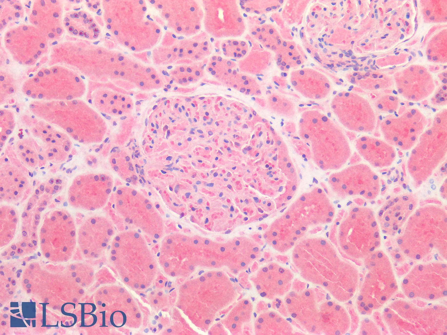 IHC-plus™ ERBB3 / HER3 Antibody (aa20-285)