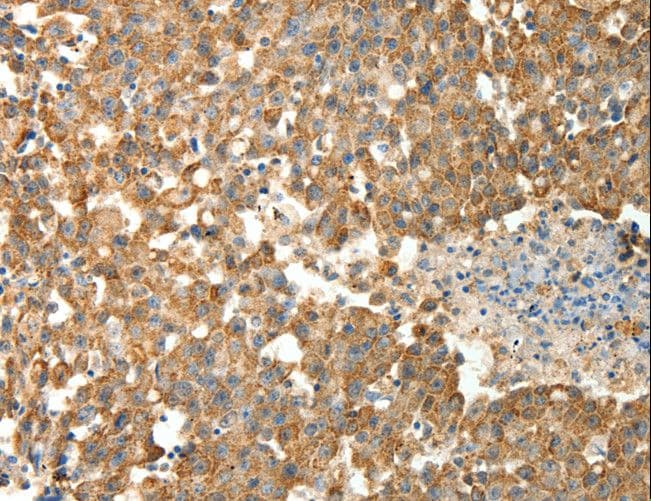 PRDX3 / Peroxiredoxin 3 Antibody