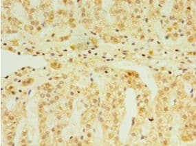 FGF6 Antibody (aa38-208)