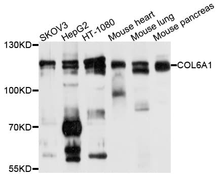 Polyclonal Rabbit anti-Human COL6A1 / Collagen VI Alpha 1 Antibody (WB)