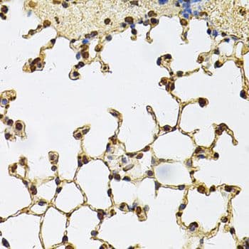 IFI16 Antibody