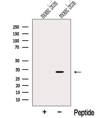 CHMP2B Antibody