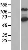 ARHGEF7 Protein (Over-Expression Lysate Myc-DDK (Flag))