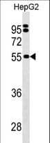 SEPSECS Antibody (aa444-474)