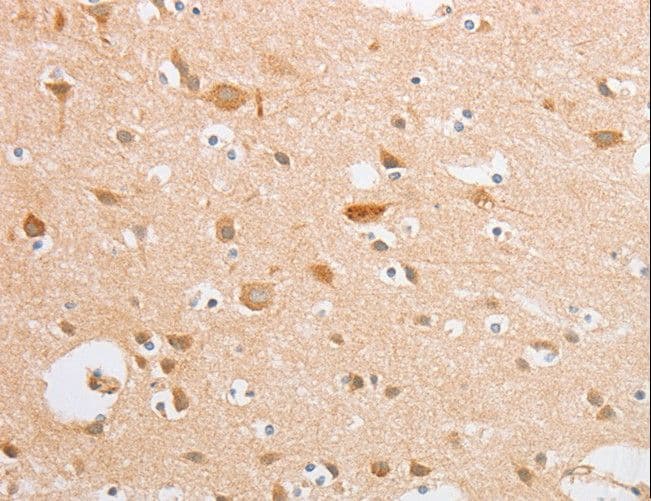 SERPINE2 / Nexin Antibody