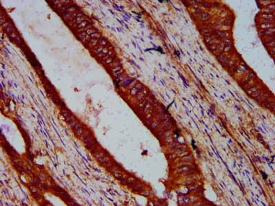 Polyclonal Rabbit anti-Human WIPF2 / WIRE Antibody (IHC)
