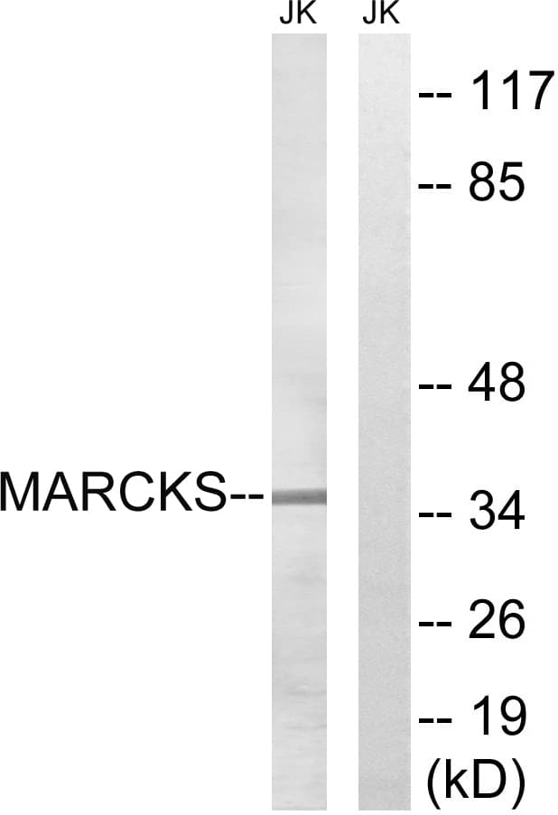 MARCKS Antibody (aa126-175)