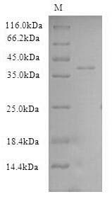 Human CSE1L Protein (Recombinant 6His-SUMO, N-terminus)