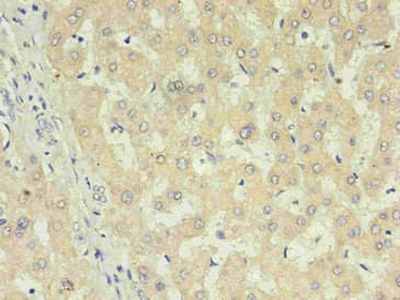 CRP / C-Reactive Protein Antibody (clone 15E7B4)