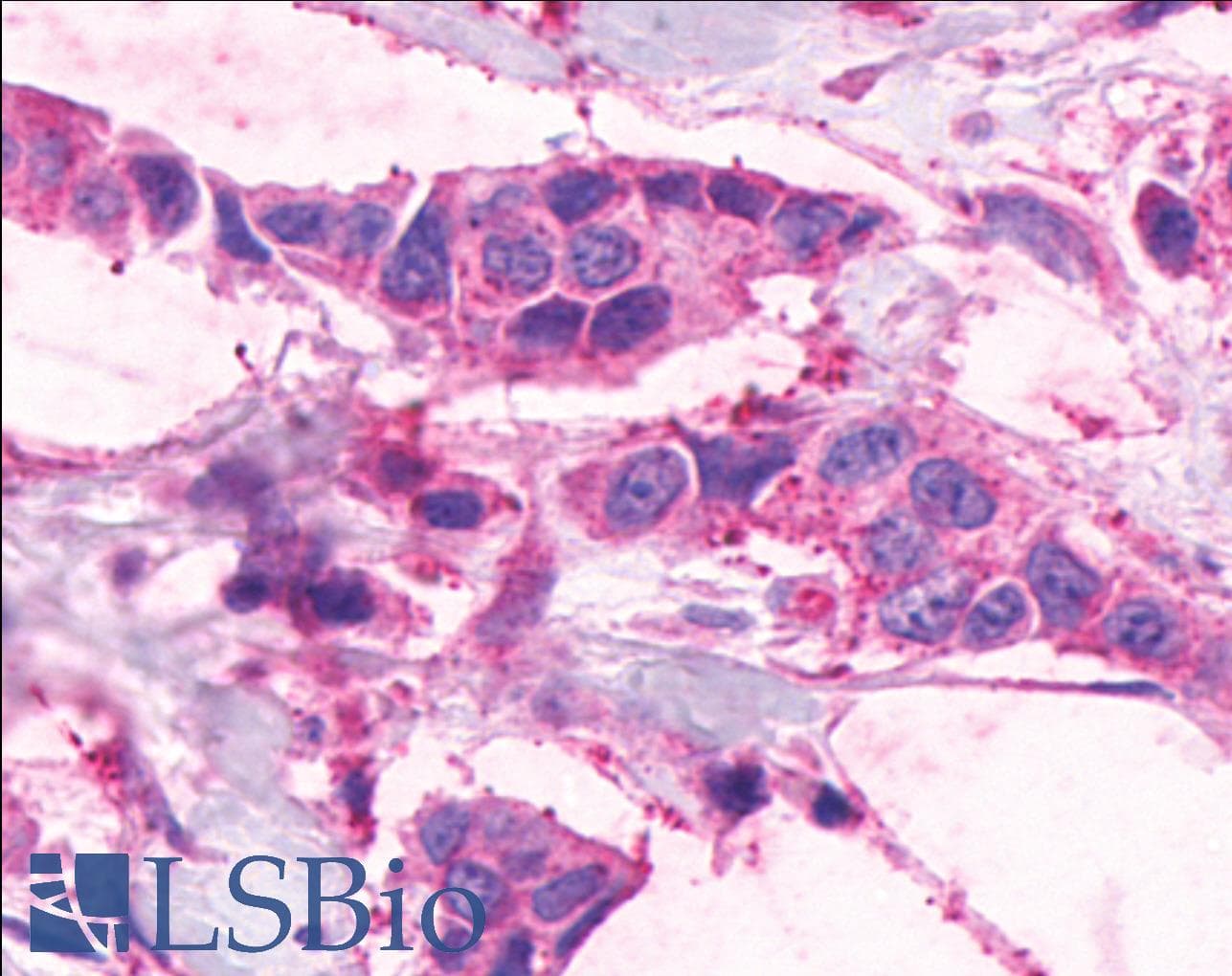 IHC-plus™ Polyclonal Rabbit anti-Human ADGRE1 / EMR1 Antibody (C-Terminus, IHC)