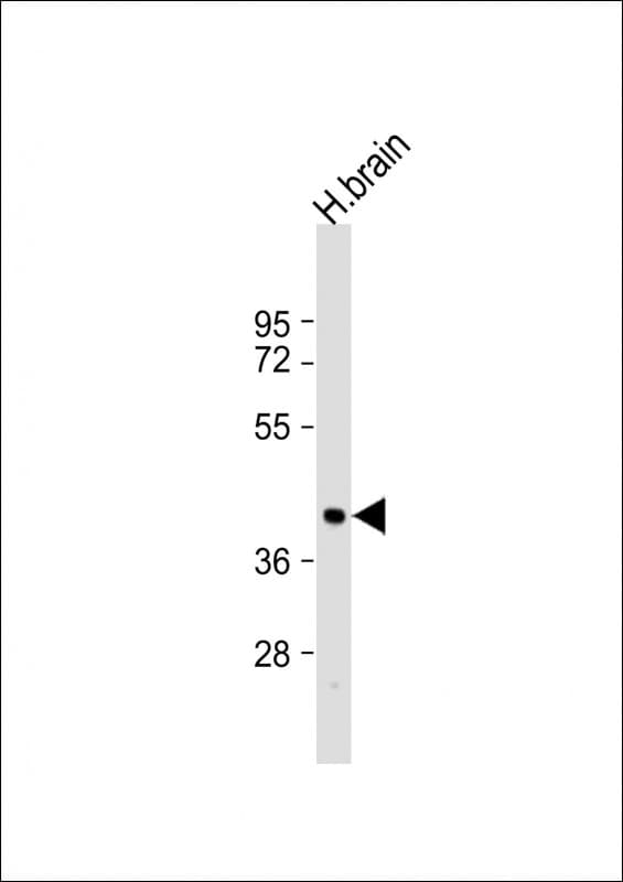 Polyclonal Rabbit anti-Human ARRB2 / Beta Arrestin 2 Antibody (aa264-298, IHC, WB)