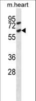 Polyclonal Rabbit anti-Mouse ACVR1C / ALK7 Antibody (aa341-368, WB)