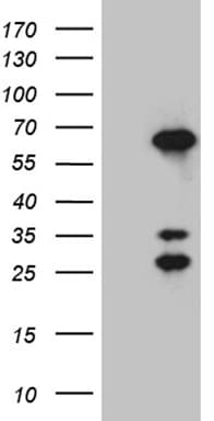 CRNN / Cornulin Antibody (clone OTI4B8, Carrier-free)
