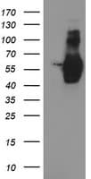 GOLM1 / GP73 / GOLPH2 Antibody (clone OTI4B12)