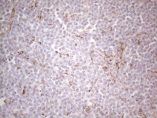 Monoclonal Mouse anti-Human Peripherin Antibody (clone UMAB202, IHC, IF, WB)