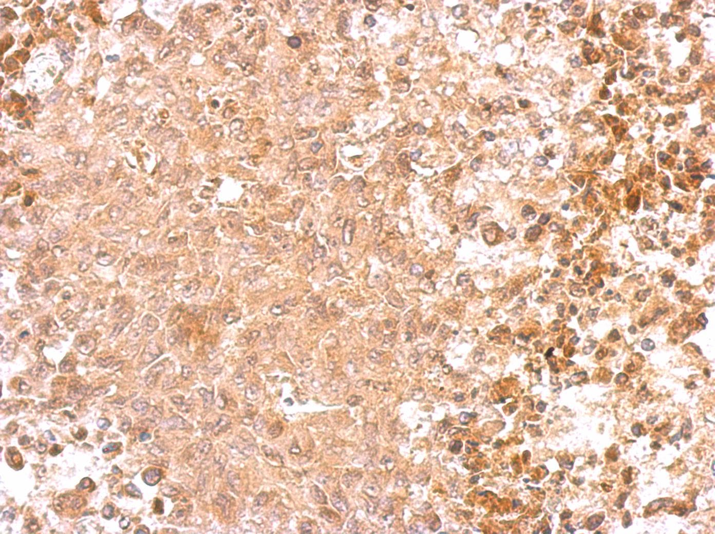 Polyclonal Rabbit anti-Human GAD65 Antibody (aa465-558, IHC, WB)