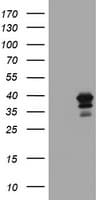 MAGEB18 Antibody (clone OTI1H2)
