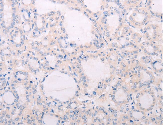 TSH Receptor / TSHR Antibody