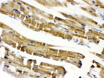CFL2 / Cofilin 2 Antibody