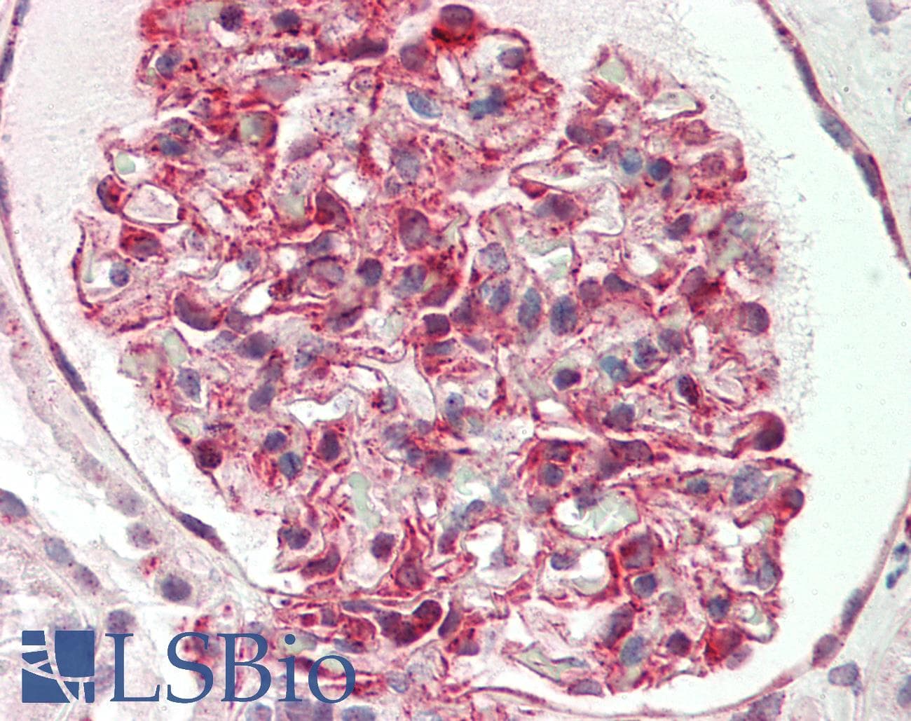 IHC-plus™ WTAP Antibody (His351)
