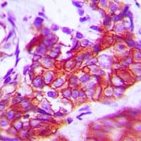 NTRK1 / TrkA Antibody (C-Terminus)