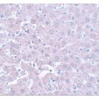 CALHM1 Antibody