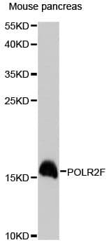 Polyclonal Rabbit anti-Human POLR2F Antibody (WB)